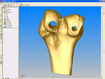 CAD model of femur head.