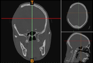 Two-dimensional orthogonal views from medical CT scan image data.