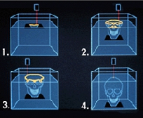 Illustraion depicting stages of biomodel fabrication via stereolithography.