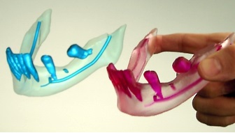 3D rendering and physical build of mandibular Biodental model.