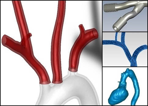 Rendered view of digital 3D model of modified blood vessel geometry with designed fittings.
