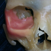 Models for Surgery and Prosthesis Production