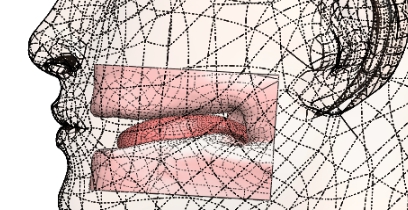 CAD parasolid model of tongue and soft tissue gingiva.